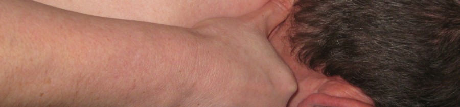 Thoracic Outlet Syndrome Thoracic Outlet Syndrome