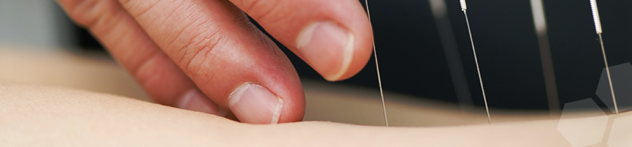 Acupuncture